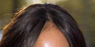 Topmodel Naomi Campbell gehen die Haare aus