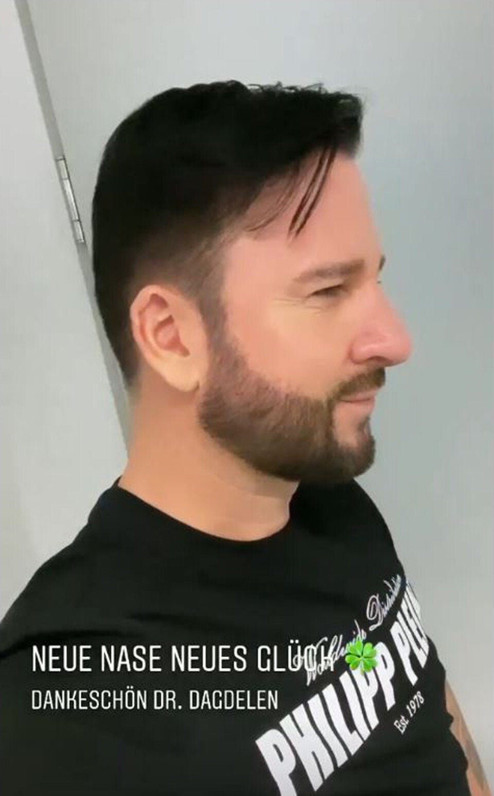 Wendler: Neue Nase trotz Megapleite