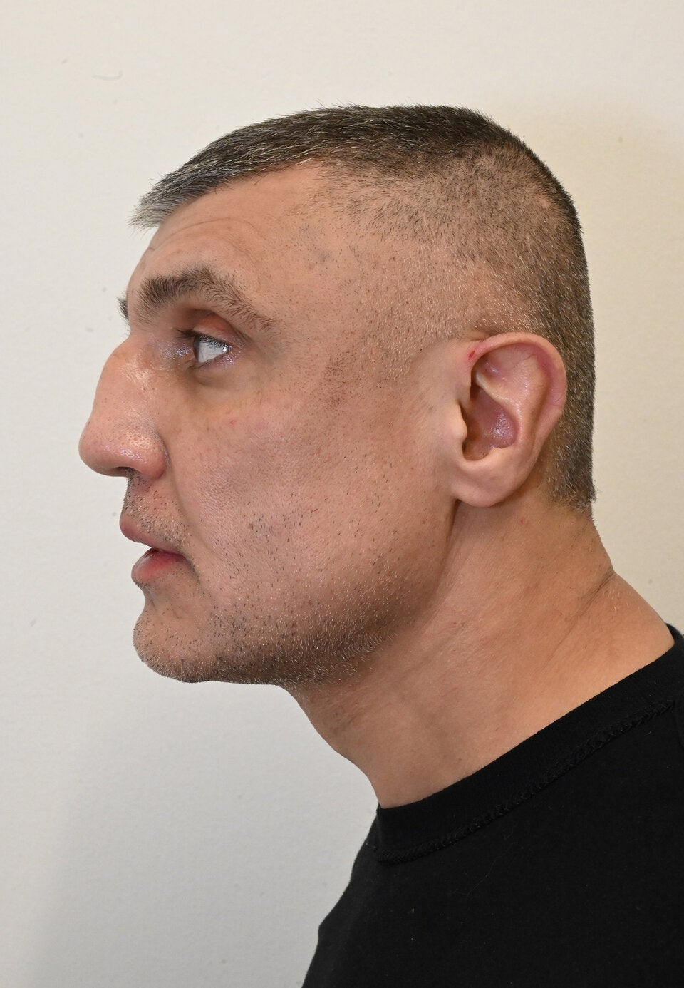 Frauen in drei Bundesländern überfallen: Polizei sucht Opfer