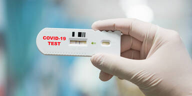 Neue Regeln f&uuml;r Corona-Tests