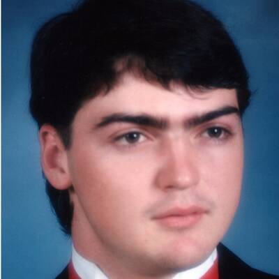 Weltweit umfangreichste Gesichtstransplantation