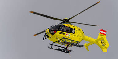 Hund bei&szlig;t Bub (1) ins Gesicht