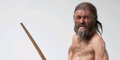 Ötzi