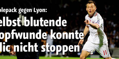 Olic schoss Lyon trotz Kopfwunde k.o.