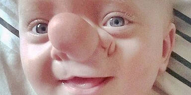 Baby w&auml;chst Gehirn aus der Nase