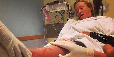Surferin (13) überlebt Hai-Attacke 
