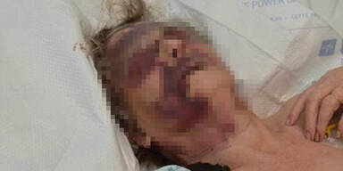 Oma (90) bei Home Invasion brutal zusammengeschlagen