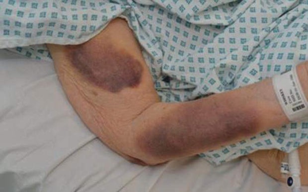 Oma (90) bei Home Invasion brutal zusammengeschlagen