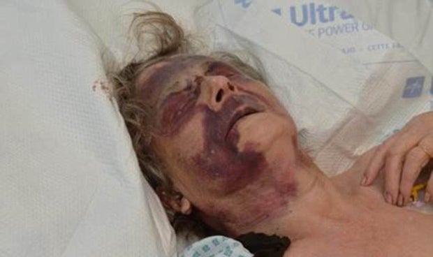 Oma (90) bei Home Invasion brutal zusammengeschlagen