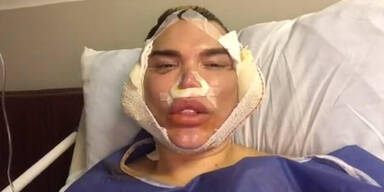 Lebende Ken-Puppe: Sechs OPs auf einen Streich