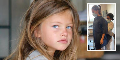 "Sch&ouml;nstes M&auml;dchen der Welt" spricht &uuml;ber Leidensgeschichte