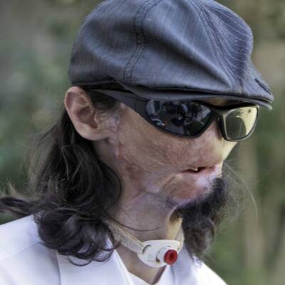 Ein Stromschlag verstümmelte den Amerikaner Dallas Wiens