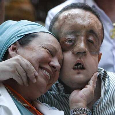 Dieser Mann trägt das Gesicht eines Toten