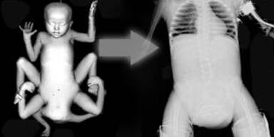 Neueste Bilder der geheilten indischen 