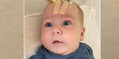 1,9 Millionen Euro: Salzburger Baby erh&auml;lt teuerste Medizin der Welt