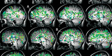 Krankenschwester hat 100 Orgasmen am Tag