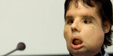 Oscar zeigt sein neues Gesicht