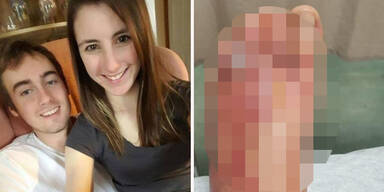 Fleischfressender Wurm bef&auml;llt P&auml;rchen