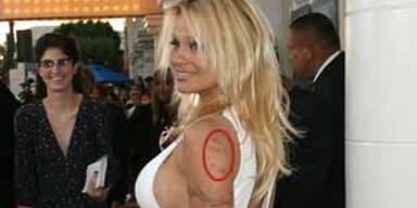 pam anderson blaue flecken