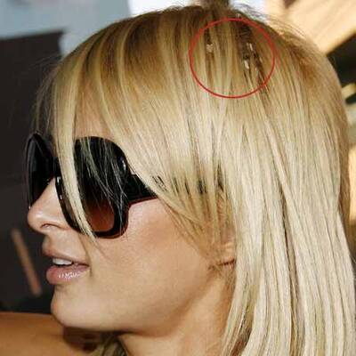 Paris Hilton hat ein haariges Problem