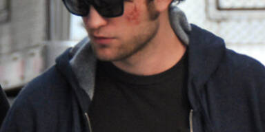 Robert Pattinson wurde verprügelt!