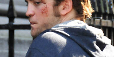 Robert Pattinson wurde verprügelt!