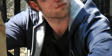 Robert Pattinson wurde verprügelt!