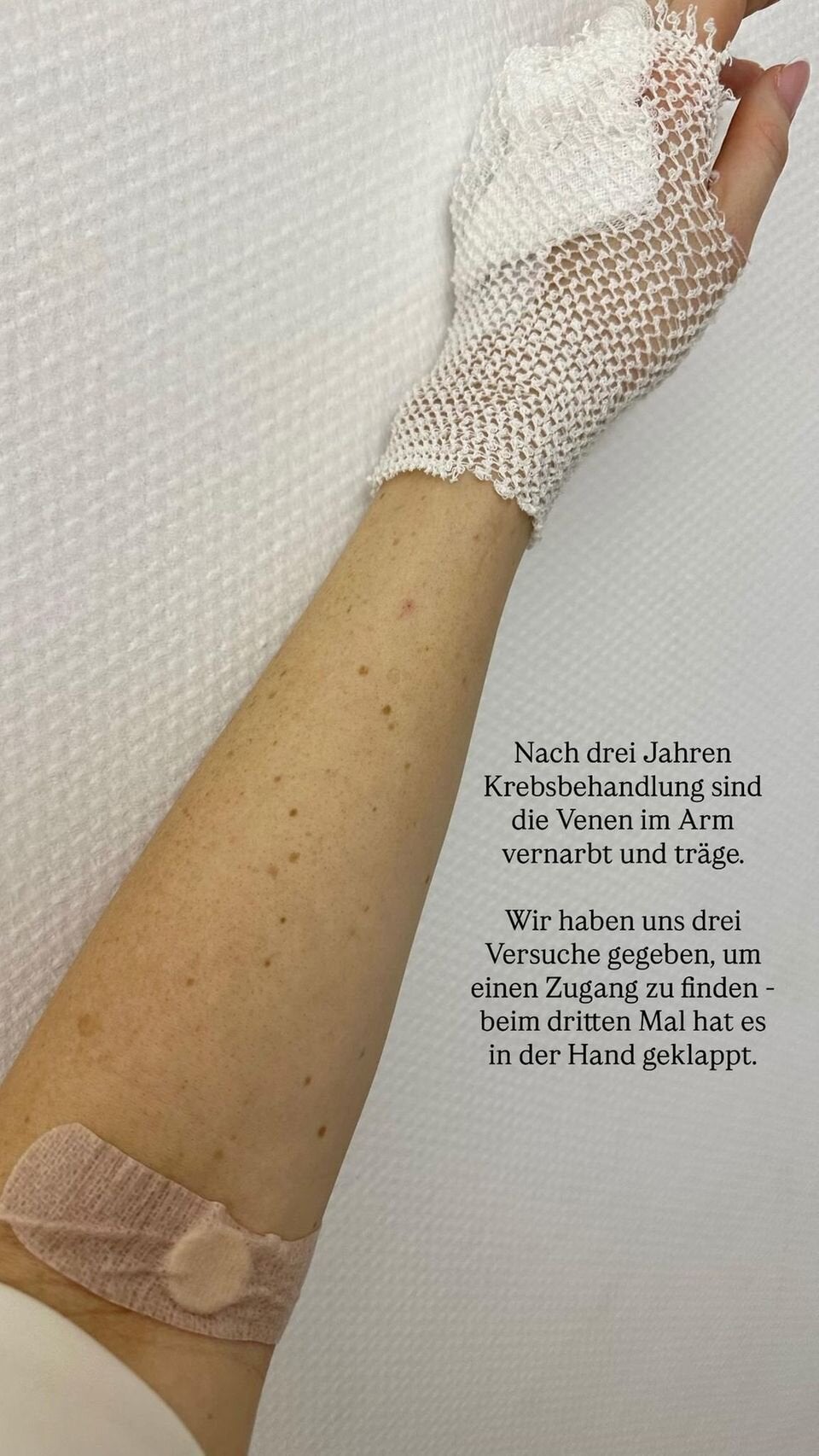 Patrice Aminati zeigt, dass ihr Körper in den letzten Jahren sehr viel durchgemacht hat. 