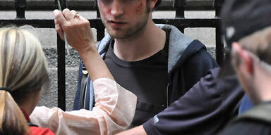 Robert Pattinson wurde verprügelt!