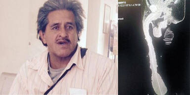 Dieser Mann hat längsten Penis der Welt