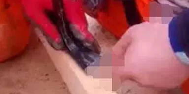 Bauarbeiter jagt sich Nagel durch den Penis