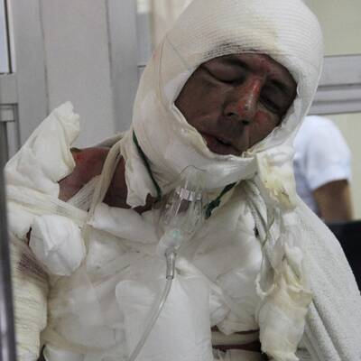 Brandinferno auf Ferieninsel Phuket