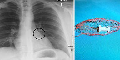 Pin-Nadel eingeatmet