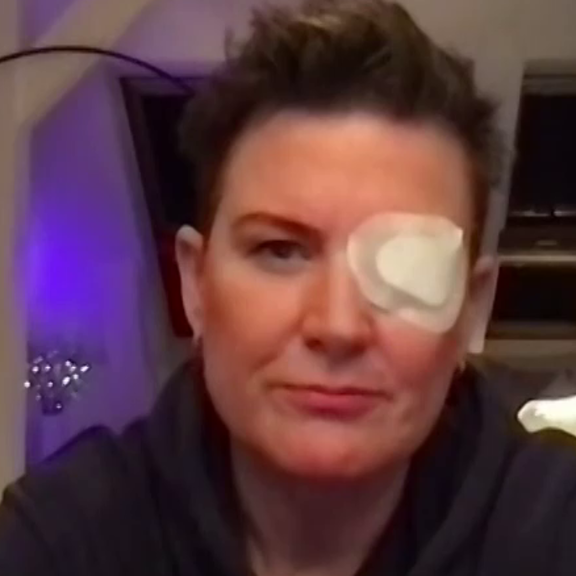 TV-Moderatorin Andrea Plewig verliert ihr Auge bei Böller-Unfall