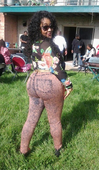 Pfusch-Ärzte: Frau stirbt nach Po-Vergrößerung