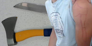 Polizei fasst den irren "K&ouml;pfer"