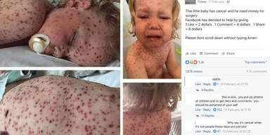 Dieser Bub hat KEINEN Krebs – die irre Geschichte dahinter