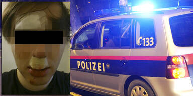 Linzer brutal verpr&uuml;gelt, weil er schwul ist