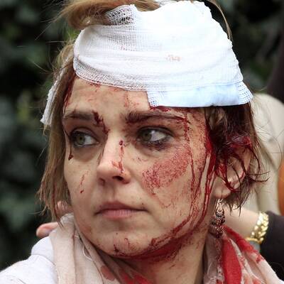 Schwere Explosion erschüttert Prag