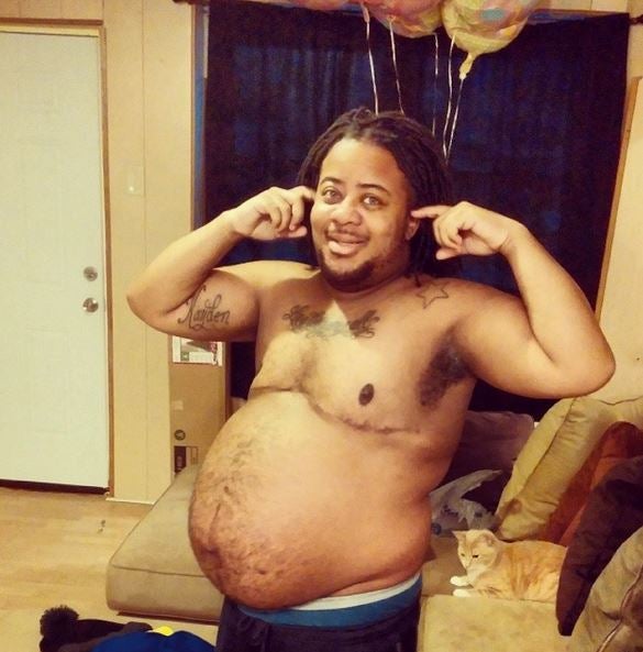 Dieser Mann wurde ungewollt schwanger