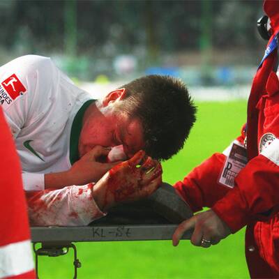 Prödl schwer am Kopf verletzt