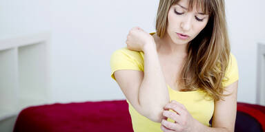 Psoriasis belastet Patienten oft schwer