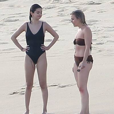 Von Not-OP: Selena Gomez zeigt Narbe