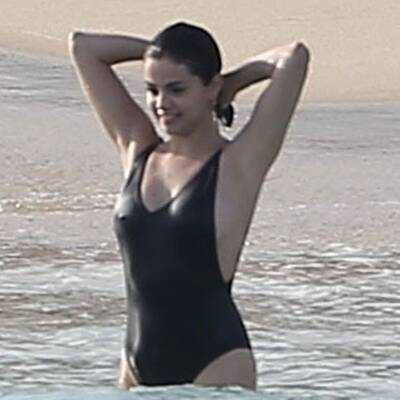 Von Not-OP: Selena Gomez zeigt Narbe