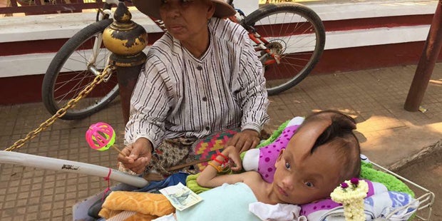 Kopf gespalten Pheaktra Pov