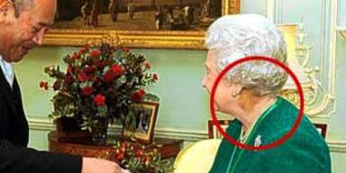 Queen hat geheimnisvolle blaue Flecken am Nacken