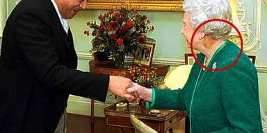 Queen hat geheimnisvolle blaue Flecken am Nacken