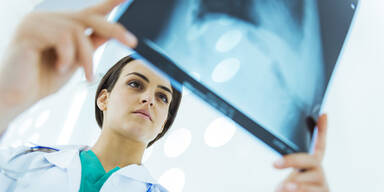Zu viel R&ouml;ntgen kann Krebs ausl&ouml;sen