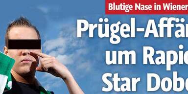 Prügel-Affäre um Rapid-Star Dober