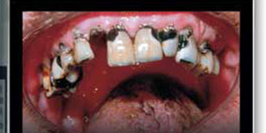 Schock-Fotos auf Zigarettenpackerln in Belgien